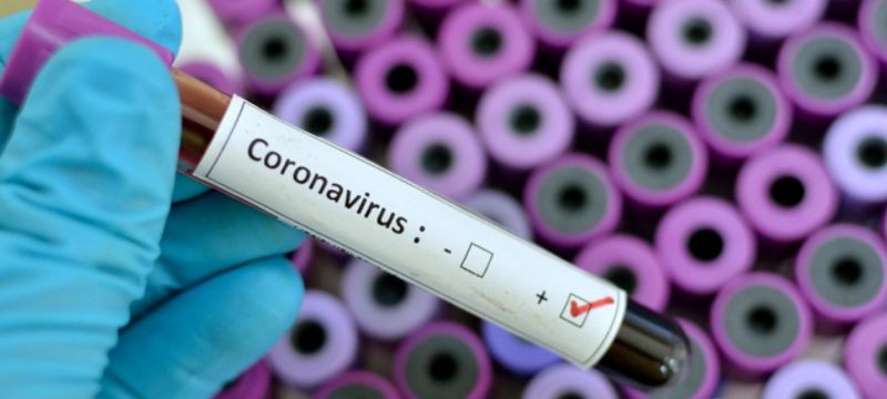 coronavirus0000