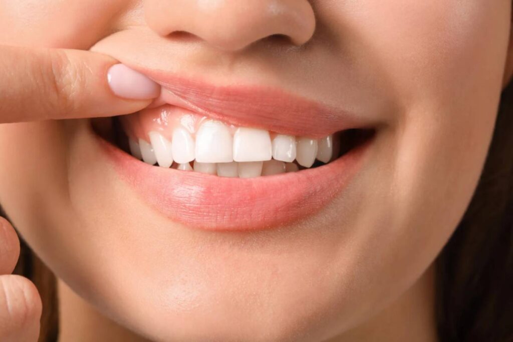 Denti splendenti