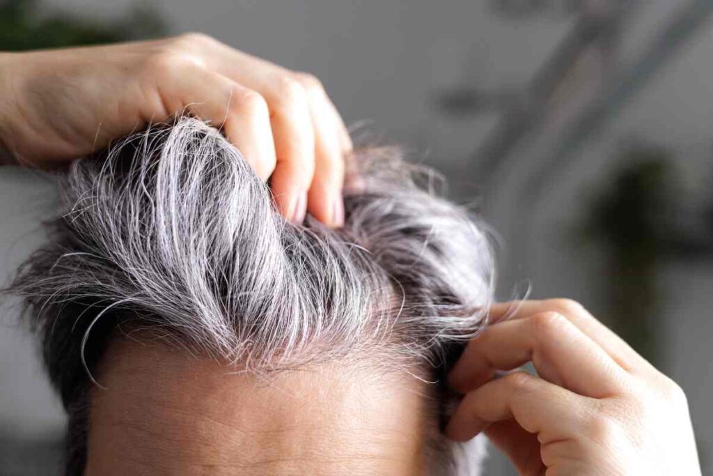 Capelli bianchi