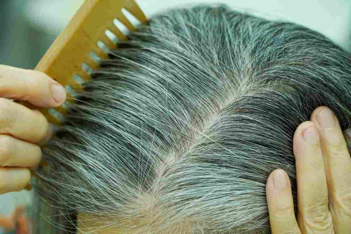Capelli bianchi